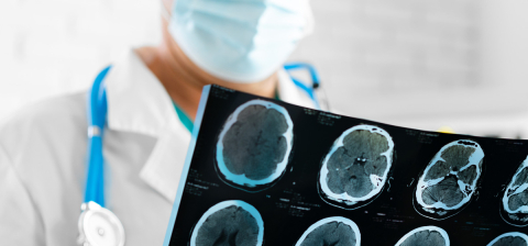 photo of doctor looking at MRI image of brain